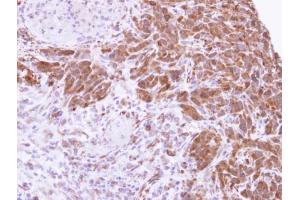 IHC-P Image Immunohistochemical analysis of paraffin-embedded SAS xenograft , using MTAP, antibody at 1:500 dilution. (MTAP antibody)