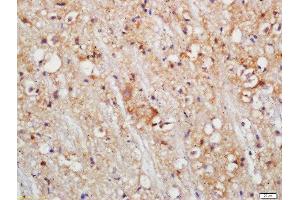 Formalin-fixed and paraffin embedded mouse brain labeled with Rabbit Anti-PLDL1 Polyclonal Antibody, Unconjugated (ABIN754588) at 1:200 followed by conjugation to the secondary antibody and DAB staining