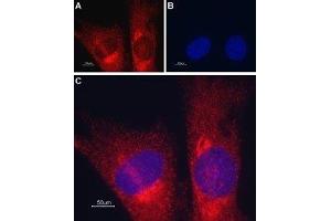 Expression of TRIC-A in mouse muscle myoblast (C2C12) cell line - Immunocytochemical staining of mouse paraformaldehyde-fixed and permeabilized muscle myoblast (C2C12) cell line. (TMEM38A antibody  (C-Term, Intracellular))