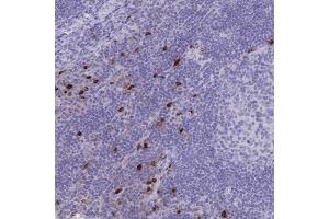 Immunohistochemical staining (Formalin-fixed paraffin-embedded sections) of human lymph node with IL2RB polyclonal antibody  shows strong cytoplasmic positivity in non-germinal center cells. (IL2 Receptor beta antibody  (AA 66-122))