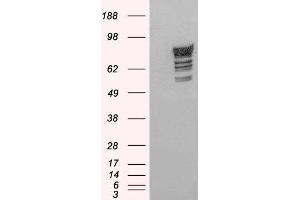 HEK293 overexpressing Human PDE4D2 and probed with ABIN2564434 (mock transfection in first lane). (PDE4D antibody  (C-Term))