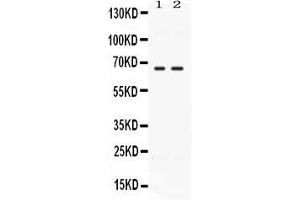 Western blot analysis of CCDC6 expression in rat testis extract ( Lane 1) and MCF-7 whole cell lysates ( Lane 2). (CCDC6 antibody  (N-Term))