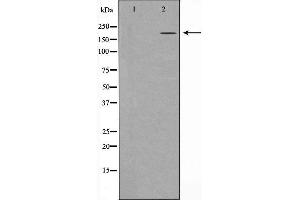 Western blot analysis of extracts of A431 , using TP53BP1 antibody. (TP53BP1 antibody  (N-Term))