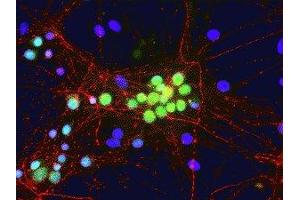 Immunofluorescence of cultured rat neurons showing nuclear and distal cytoplasmic staining of FOX1 in green. (A2BP1 antibody  (N-Term))