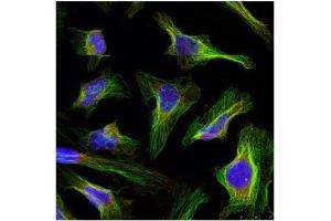 Image no. 2 for anti-B-Cell CLL/lymphoma 2 (BCL2) (AA 54-58) antibody (ABIN197203) (Bcl-2 antibody  (AA 54-58))