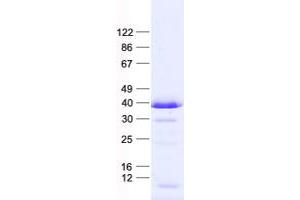 Validation with Western Blot (ING1 Protein (His tag))