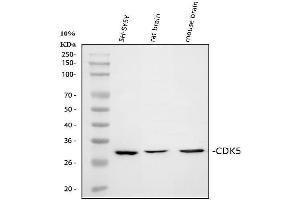 Western blot analysis of CDK5 using anti-CDK5 antibody (ABIN6719393).