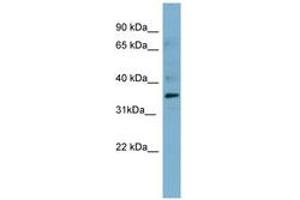 Image no. 2 for anti-Mesothelin (MSLN) (AA 395-444) antibody (ABIN6741693) (Mesothelin antibody  (AA 395-444))