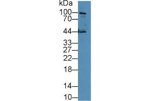 Detection of 0 in Human PC3 cell lysate using Polyclonal Antibody to E-cadherin