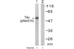 Image no. 1 for anti-Microtubule-Associated Protein tau (MAPT) (pSer214) antibody (ABIN196804) (MAPT antibody  (pSer214))
