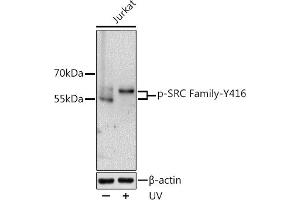 Western blot analysis of extracts of Jurkat cells, using Phospho-SRC Family-Y416 antibody (ABIN6135254, ABIN6136132, ABIN6136133 and ABIN6225536) at 1:1000 dilution. (Src Family (pTyr416) antibody)