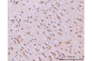 IHC analysis of RIMBP2 using anti-RIMBP2 antibody (ABIN7601441). (RIMBP2 antibody  (AA 351-1049))