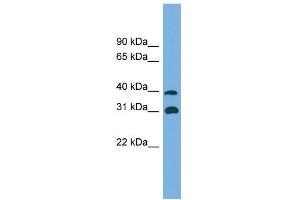 WB Suggested Anti-CRYM Antibody Titration: 0. (CRYM antibody  (Middle Region))