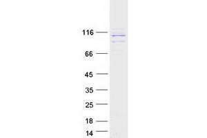 Western Blotting (WB) image for Ribosome Binding Protein 1 (RRBP1) (Transcript Variant 1) protein (Myc-DYKDDDDK Tag) (ABIN2731196)
