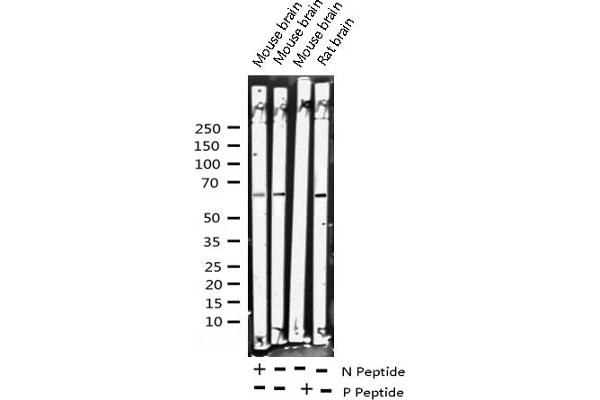 ELK1 antibody  (pSer383)