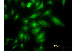 Immunofluorescence of monoclonal antibody to TRAPPC4 on HeLa cell. (TRAPPC4 antibody  (AA 1-219))