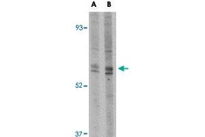 Western blot analysis of Trim30 in mouse heart tissue lysate with Trim30 polyclonal antibody  at (A) 1 and (B) 2 ug/mL .