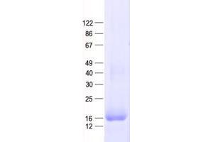 Validation with Western Blot (PLAC2 Protein (His tag))