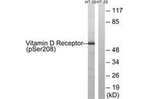 Western blot analysis of extracts from HT29 cells treated with heat shock, using Vitamin D Receptor (Phospho-Ser208) Antibody. (Vitamin D Receptor antibody  (pSer208))