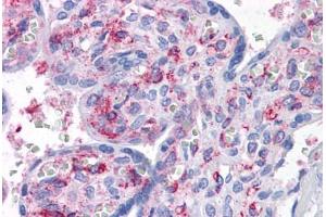 Human Placenta: Formalin-Fixed, Paraffin-Embedded (FFPE) (CAB39L antibody  (AA 1-367))