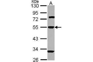 WB Image Sample (30 ug of whole cell lysate) A: Hep G2 , 10% SDS PAGE antibody diluted at 1:1000 (SERPINA1 antibody  (Center))