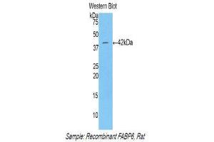 Western Blotting (WB) image for anti-Fatty Acid Binding Protein 6, Ileal (FABP6) (AA 1-128) antibody (ABIN1858785) (FABP6 antibody  (AA 1-128))