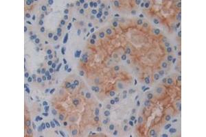 Figure. (ECF antibody  (AA 24-97))