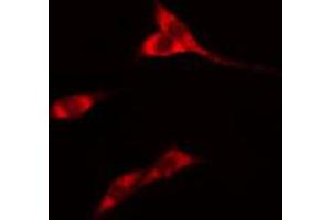 ABIN6274564 staining Hela cells by IF/ICC. (14-3-3 eta antibody  (Internal Region))