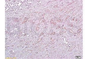Formalin-fixed and paraffin embedded rat brain tissue labeled with :  Anti-5-HTR2A Polyclonal Antibody, unconjugated (ABIN737016)  at 1: 200 followed by incubation with conjugated secondary antibody and DAB staining (HTR2A antibody  (AA 65-160))