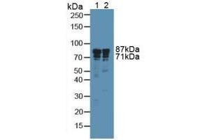 Western blot analysis of (1) Human A549 Cells and (2) Human Liver Tissue. (Integrin beta 3 antibody  (AA 135-377))