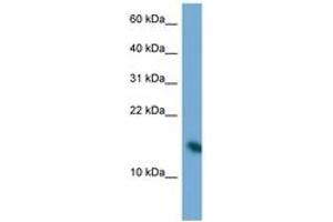 Image no. 1 for anti-Poly Binding Protein Interacting Protein 2 (PAIP2) (N-Term) antibody (ABIN6747240) (PAIP2 antibody  (N-Term))