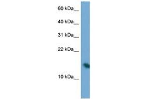 PAIP2 antibody  (N-Term)