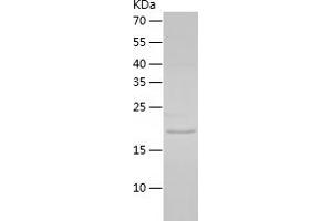 Western Blotting (WB) image for DNA segment, Chr 17, Wayne State University 104, expressed (D17Wsu104e) (AA 32-173) protein (His tag) (ABIN7122687)