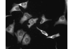 Immunofluorescent staining of A549 (ATCC CCL-185) cells. (CAMP-Dependent Protein Kinase R1 (PKA-R1) (AA 225-381) antibody)