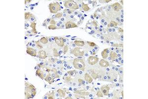 Immunohistochemistry of paraffin-embedded human stomach using OTC antibody at dilution of 1:100 (x40 lens).