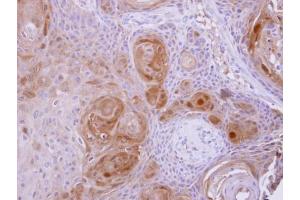IHC-P Image BBOX1 antibody detects BBOX1 protein at cytosol on Ca922 xenograft by immunohistochemical analysis. (BBOX1 antibody  (Center))