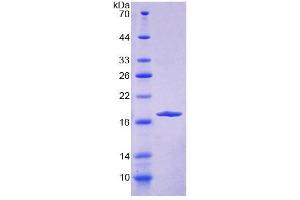 SDS-PAGE (SDS) image for Endoplasmic Reticulum Protein 29 (ERP29) (AA 42-173) protein (His tag) (ABIN4989268)