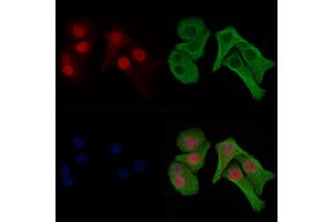 ABIN6256486 and ABIN6274031 staining Hela cells(heat shock treatment) by IF/ICC. (Histone H1.3 antibody  (pThr18))