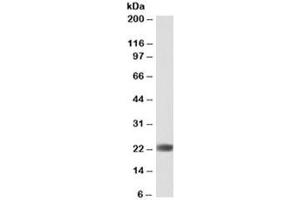 Western blot testing of human liver lysate with BLVRB antibody at 0. (BLVRB antibody)