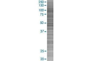 IL1RAP transfected lysate. (IL1RAP 293T Cell Transient Overexpression Lysate(Denatured))