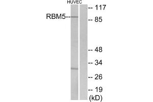 Western blot analysis of extracts from HUVEC cells, using RBM5 antibody. (RBM5 antibody  (Internal Region))