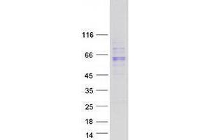 Validation with Western Blot (UGT1A10 Protein (Myc-DYKDDDDK Tag))