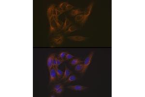 Immunofluorescence analysis of U-2 OS cells using EB3/M Rabbit mAb (ABIN7268535) at dilution of 1:100 (40x lens).