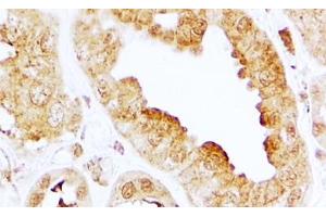 ABIN5539719 (2µg/ml) staining of paraffin embedded Human Kidney.