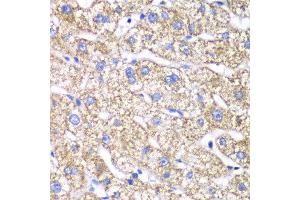 Immunohistochemistry of paraffin-embedded human liver injury using DLST antibody at dilution of 1:100 (x40 lens). (DLST antibody)