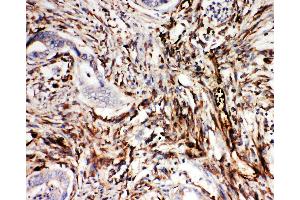 Immunohistochemistry (IHC) image for anti-Neuregulin 1 (NRG1) (AA 617-636), (C-Term) antibody (ABIN3044035)