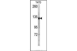 Image no. 1 for anti-Desmoglein 2 (DSG2) (N-Term) antibody (ABIN360106) (Desmoglein 2 antibody  (N-Term))