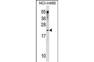 Western blot analysis in NCI-H460 cell line lysates (35ug/lane). (G-CSF antibody  (C-Term))
