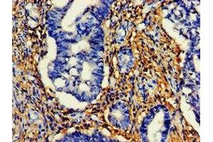 Immunohistochemistry (IHC) image for anti-HtrA Serine Peptidase 2 (HTRA2) (AA 334-458) antibody (ABIN7168921)