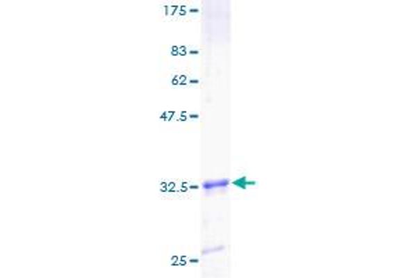 TIMM8A/DDP Protein (AA 1-72) (GST tag)